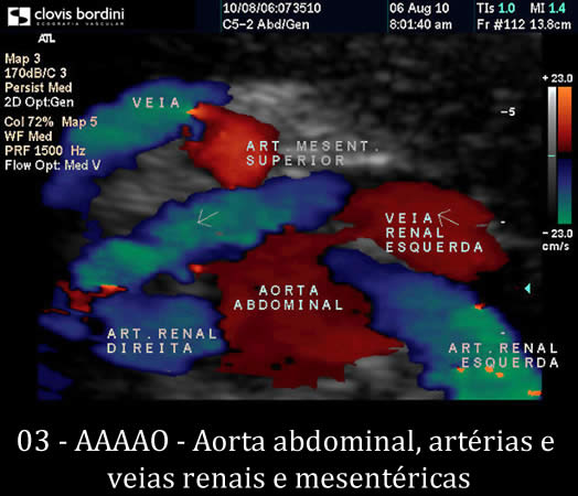 Aorta abdominal, artérias e veias renais e mesentéricas